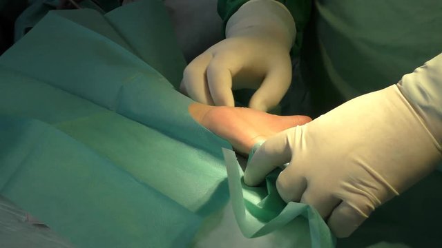Ein Chirurg f&uuml;hrt eine Karpaltunnel-Syndrom-OP durch