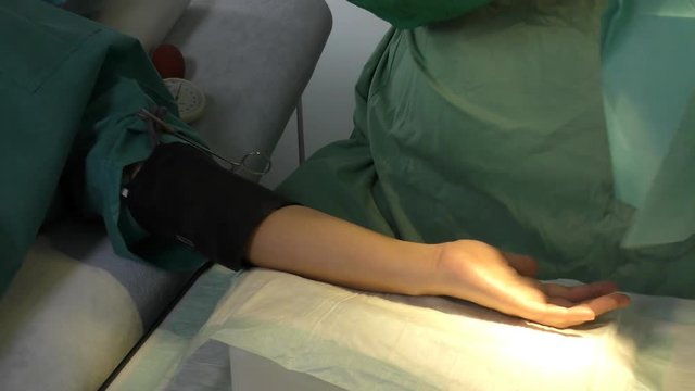 Ein Chirurg f&uuml;hrt eine Karpaltunnel-Syndrom-OP durch