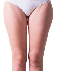 Woman in white panties with cellulite on her legs