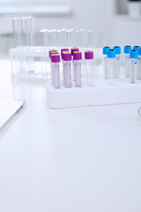 Research laboratory working space. Test tubes and tablet PC are lying at the table. Medical equipment. Blood test