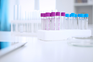 Research laboratory working space. Test tubes and tablet PC are lying at the table. Medical equipment. Blood test