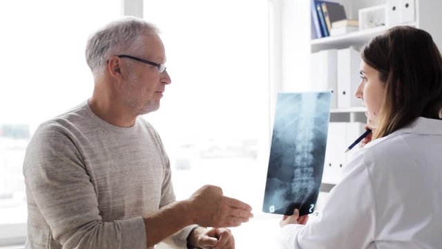 doctor with spine x-ray and senior man at hospital 73