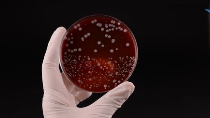 Scientist's hand checking petri dish infected with Staphylococcus aureus bacteria
