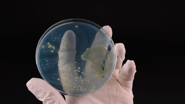 Scientist's hand checking petri dish and pointing with inoculation loop Proteus bacteria