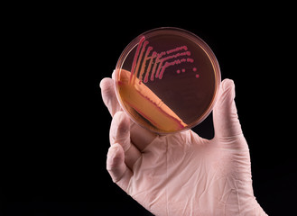 Laboratory doctor hand with sterile glove holding petri dish infected with Yersinia bacteria