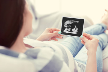 Young pregnant woman with the ultra sound photo of her baby