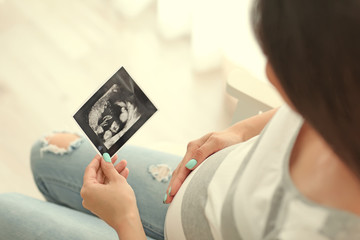 Young pregnant woman with the ultra sound photo of her baby