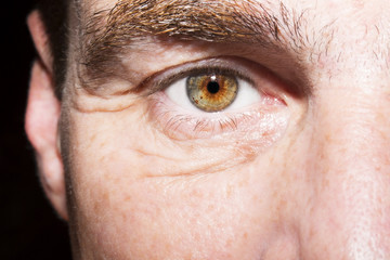 Image of man's brown eye close up.