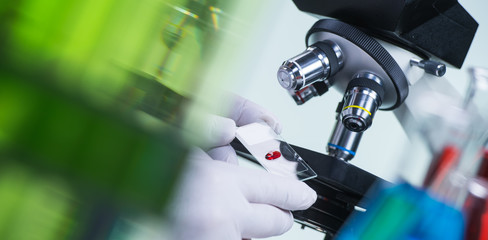 Laboratory scientist holding a slide containing a blood sample w