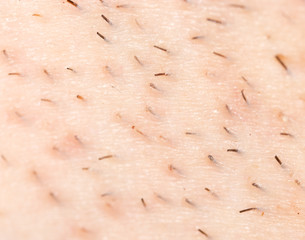 Fototapeta premium the bristles on the skin. macro