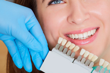 Close-up of a girl with a beautiful smile at the dentist.  Dental care concept. Set of implants with various shades of tone