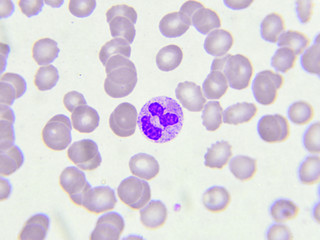 White blood cell in peripheral blood smear, Wright stain
