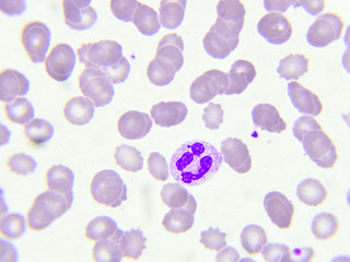 White blood cell in peripheral blood smear, Wright stain

