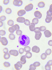 White blood cell in blood smear
