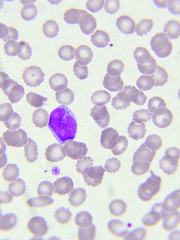 White blood cell in blood smear
