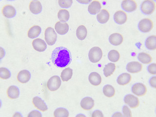 White blood cell in blood smear
