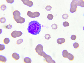 White blood cell in blood smear
