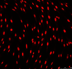 Confocal microscopy of fibroblasts nuclei