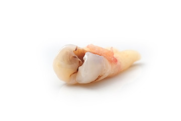 teeth Caries isolated on white background