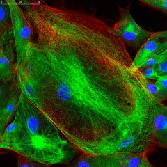 Confocal microscopy of fibroblast cells
