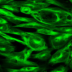Obraz na płótnie Canvas Confocal microscopy of fibroblast cells