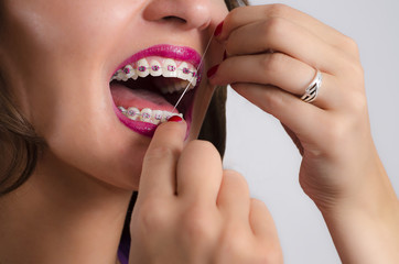 Closeup of young woman with braces flossing teeth