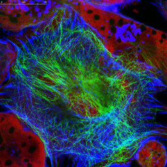 Real fluorescence microscopic view of mice neuroblastoma cell line