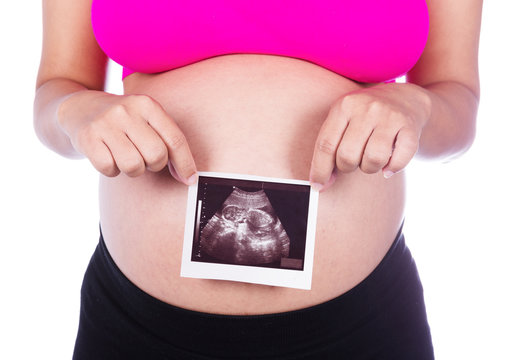 Pregnant woman hands holding ultrasound photo on white backgroun