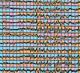 brain wave on electroencephalogram EEG for epilepsy, illustration