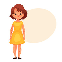 Little girl having chickenpox, cartoon style vector illustration isolated on white background. Cute brown haired girl in yellow dress with smallpox pimples, catching childhood desease