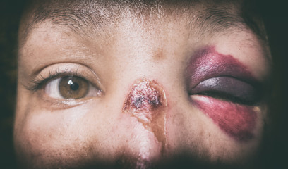 Battered woman with monocle