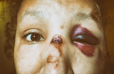 Battered woman with monocle