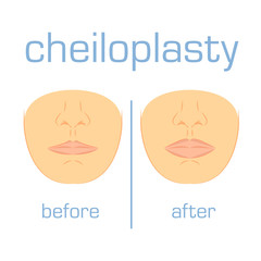 Correction form size lip white back