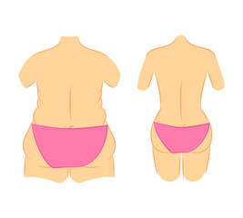 Butt lift correction waist line