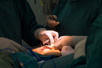 openheart surgery for coronary surgery