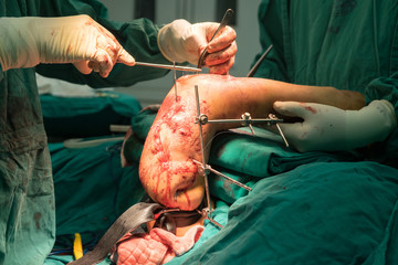 orthopedic surgery