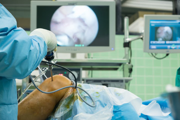 arthroscope surgery