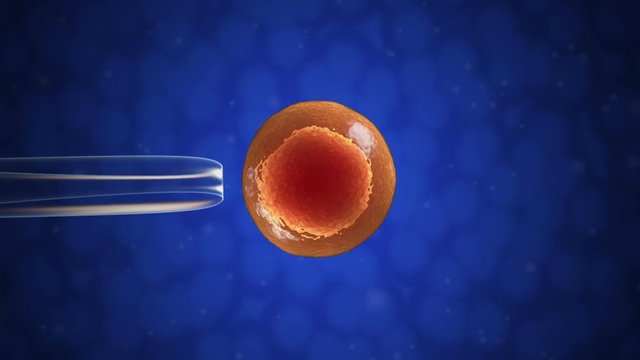 In vitro fertilization.
