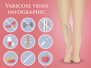 phlebology vector infographic