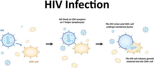 HIV Infection - obrazy, fototapety, plakaty