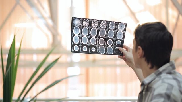 Handsome man sits at table and tries to analize x-rays.