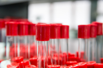 Close-up detail of multiple red capped test tubes standing straight up. Heathcare and science concept.