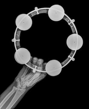 X-ray of a hand holding a tambourine