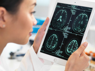 Doctor viewing CT scan result of brain on digital tablet for abnormalities