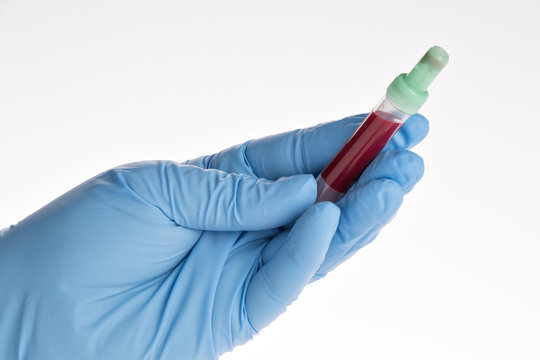 Arzt h&auml;lt Blutprobe in der Hand (gro&szlig;es Blutbild)