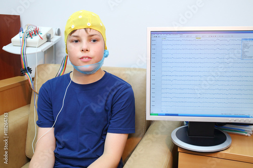 the use of electroencephalography in neurological monitoring the use of electroencephalography in neurological monitoring