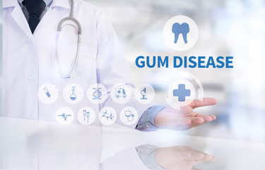 GUM DISEASE  Medical concept Doctor