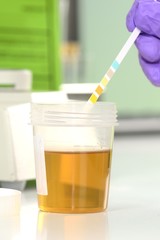 Urinprobe im Labor mit Urinteststreifen
