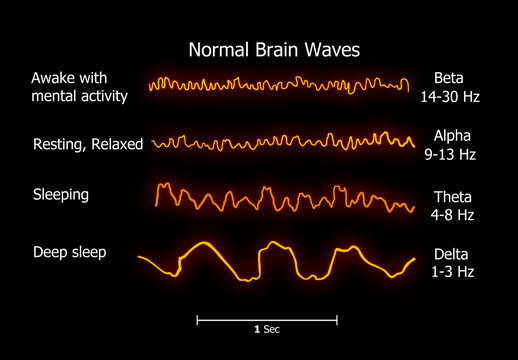 Illustration of the Normal-brain-waves

