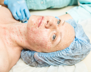 Beautician makes biorevitalization to young woman. The cosmetic procedures for the face. Beauty treatments in the spa salon. Facial Skin Care